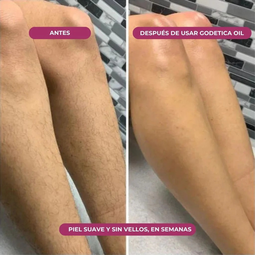 Aceite Godetica™ - Menos Vello, Más Suavidad